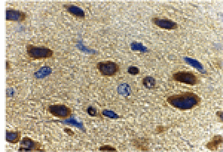 Immunohistochemistry - Adiponectin Antibody from Signalway Antibody (24323) - Antibodies.com