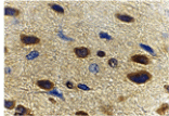 Immunohistochemistry - Adiponectin Antibody from Signalway Antibody (24323) - Antibodies.com