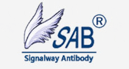 Western blot - Adiponectin Antibody from Signalway Antibody (24324) - Antibodies.com
