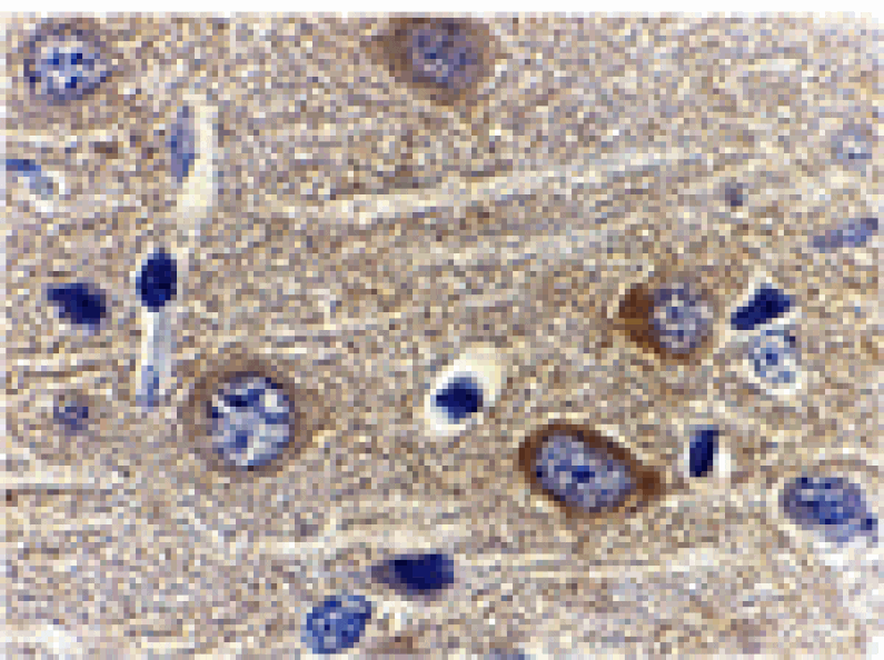 Immunohistochemistry - Adiponectin Antibody from Signalway Antibody (24324) - Antibodies.com