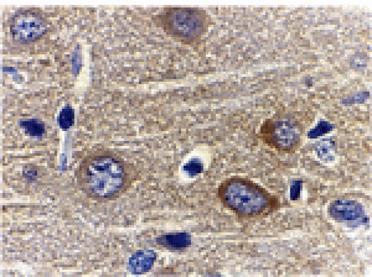 Immunohistochemistry - Adiponectin Antibody from Signalway Antibody (24324) - Antibodies.com