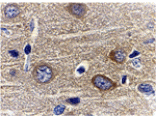 Immunohistochemistry - Adiponectin Antibody from Signalway Antibody (24324) - Antibodies.com