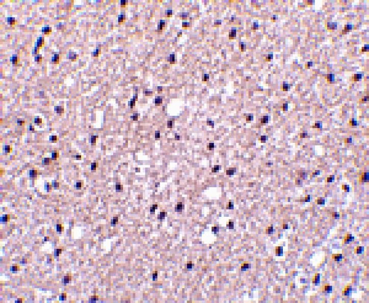 Immunohistochemistry - Presenilin1 Antibody from Signalway Antibody (24526) - Antibodies.com