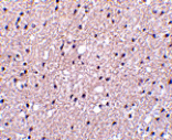 Immunohistochemistry - Presenilin1 Antibody from Signalway Antibody (24526) - Antibodies.com