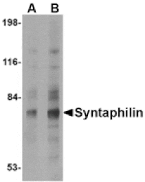 Western blot - Syntaphilin Antibody from Signalway Antibody (24689) - Antibodies.com