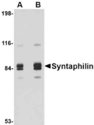 Western blot - Syntaphilin Antibody from Signalway Antibody (24698) - Antibodies.com