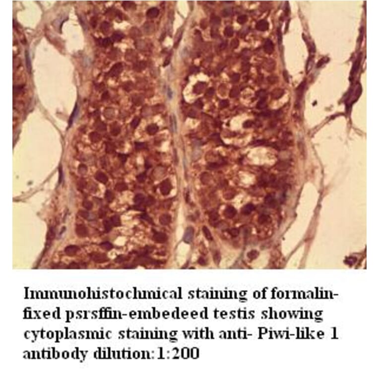 Piwi-like 1 Antibody from Signalway Antibody (39273) - Antibodies.com