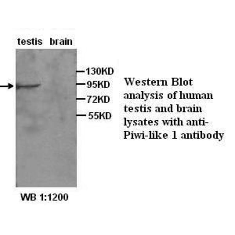 Piwi-like 1 Antibody from Signalway Antibody (39273) - Antibodies.com
