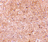 Immunohistochemistry - Caspase-13 Antibody from Signalway Antibody (24097) - Antibodies.com