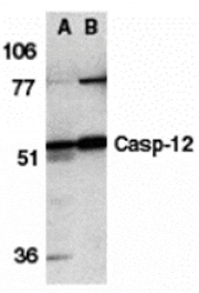 Western blot - Caspase-12 Antibody from Signalway Antibody (24119) - Antibodies.com