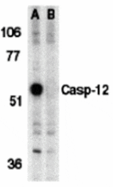 Western blot - Caspase-12 Antibody from Signalway Antibody (24120) - Antibodies.com