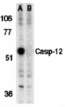 Western blot - Caspase-12 Antibody from Signalway Antibody (24120) - Antibodies.com