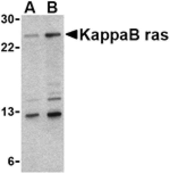 Western blot - KappaB ras Antibody from Signalway Antibody (24150) - Antibodies.com