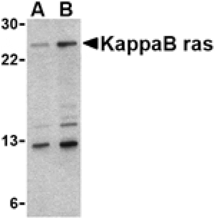 Western blot - KappaB ras Antibody from Signalway Antibody (24150) - Antibodies.com