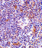 Immunohistochemistry - KappaB ras Antibody from Signalway Antibody (24150) - Antibodies.com