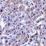 Immunohistochemistry - Caspase-14 Antibody from Signalway Antibody (24157) - Antibodies.com