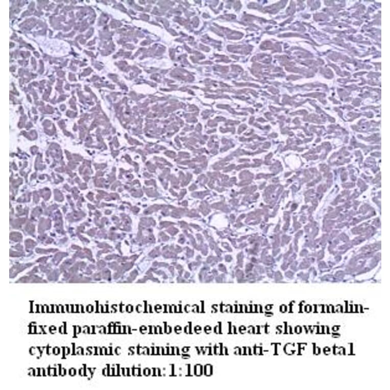 TGF&beta;1 Antibody from Signalway Antibody (39303) - Antibodies.com