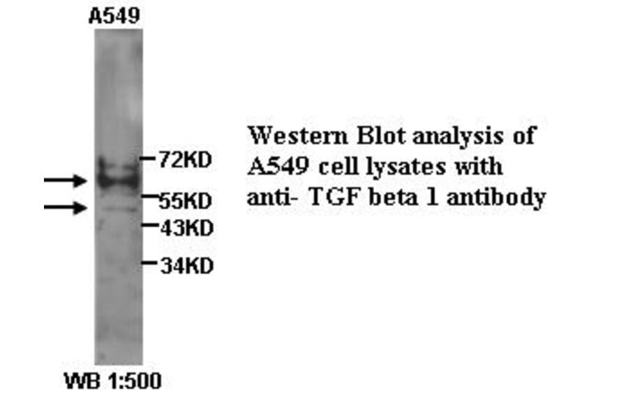 TGF&beta;1 Antibody from Signalway Antibody (39303) - Antibodies.com