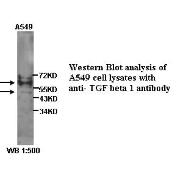 TGF&beta;1 Antibody from Signalway Antibody (39303) - Antibodies.com