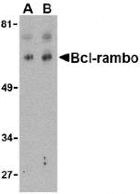 Western blot - Bcl-rambo Antibody from Signalway Antibody (24167) - Antibodies.com