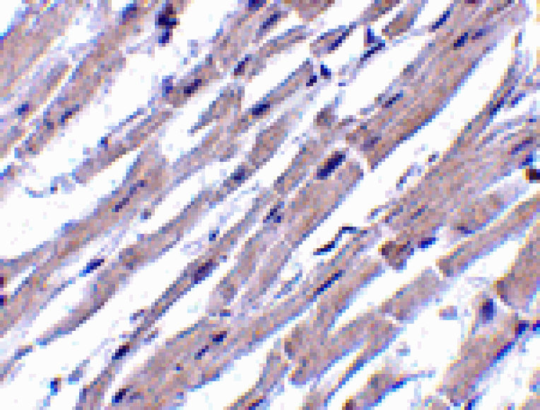 Immunohistochemistry - Bcl-rambo Antibody from Signalway Antibody (24167) - Antibodies.com