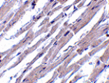 Immunohistochemistry - Bcl-rambo Antibody from Signalway Antibody (24167) - Antibodies.com