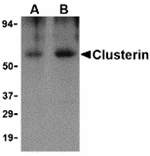 Western blot - Clusterin Antibody from Signalway Antibody (24428) - Antibodies.com