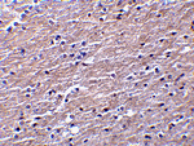 Immunohistochemistry - Clusterin Antibody from Signalway Antibody (24428) - Antibodies.com