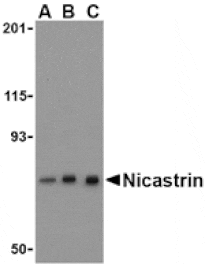 Western blot - Nicastrin Antibody from Signalway Antibody (24471) - Antibodies.com