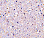 Immunohistochemistry - Nicastrin Antibody from Signalway Antibody (24471) - Antibodies.com