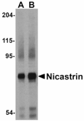 Western blot - Nicastrin Antibody from Signalway Antibody (24472) - Antibodies.com