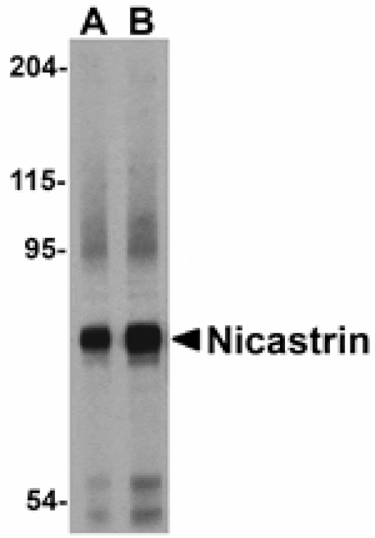 Western blot - Nicastrin Antibody from Signalway Antibody (24472) - Antibodies.com