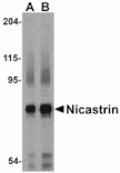 Western blot - Nicastrin Antibody from Signalway Antibody (24472) - Antibodies.com