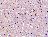 Immunohistochemistry - Nicastrin Antibody from Signalway Antibody (24472) - Antibodies.com