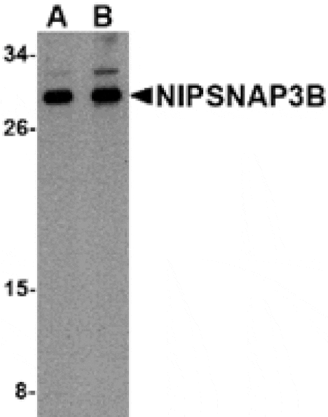 Western blot - NIPSNAP3B Antibody from Signalway Antibody (24810) - Antibodies.com