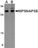 Western blot - NIPSNAP3B Antibody from Signalway Antibody (24810) - Antibodies.com