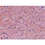 Immunohistochemistry - Prosapip1 Antibody from Signalway Antibody (24968) - Antibodies.com