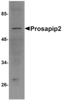 Western blot - Prosapip2 Antibody from Signalway Antibody (24969) - Antibodies.com