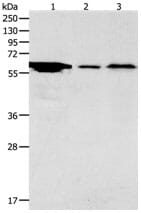Gel: 10% SDS-PAGE Lane1: Hela cell lysate Lane2: Mouse stomach tissue lysate Lane3: Brain tissue lysate. Lysates: 40 µg per lane. Primary antibody: 1/2000 dilution. Secondary antibody: Goat anti Rabbit IgG - H&L (HRP) at 1/10000 dilution. Exposure time: 5 minutes