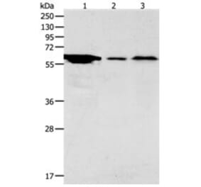 ADCYAP1R1 Antibody from Signalway Antibody (31286) - Antibodies.com