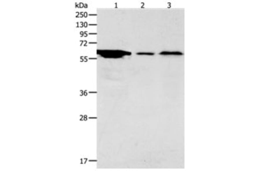 ADCYAP1R1 Antibody from Signalway Antibody (31286) - Antibodies.com