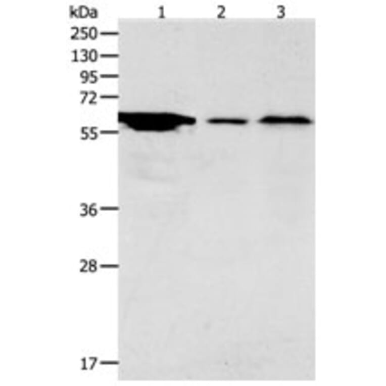 ADCYAP1R1 Antibody from Signalway Antibody (31286) - Antibodies.com