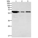 ADCYAP1R1 Antibody from Signalway Antibody (31286) - Antibodies.com