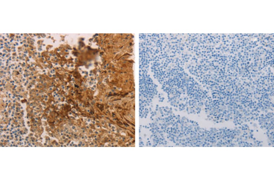 ADCYAP1R1 Antibody from Signalway Antibody (31286) - Antibodies.com