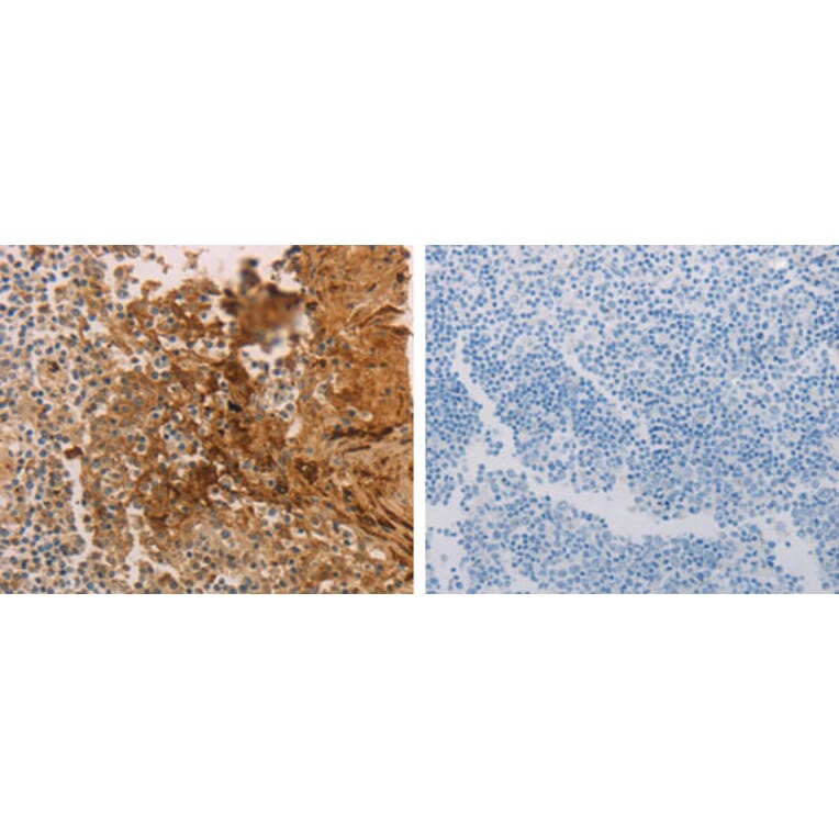 ADCYAP1R1 Antibody from Signalway Antibody (31286) - Antibodies.com