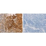 ADCYAP1R1 Antibody from Signalway Antibody (31286) - Antibodies.com