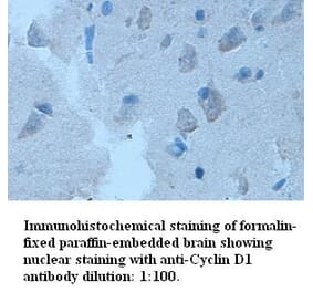 Cyclin D1 Antibody from Signalway Antibody (39315) - Antibodies.com