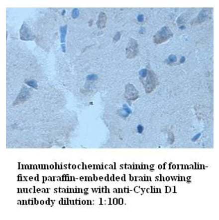 Cyclin D1 Antibody from Signalway Antibody (39315) - Antibodies.com