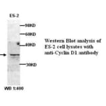 Cyclin D1 Antibody from Signalway Antibody (39315) - Antibodies.com