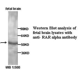RAR alpha Antibody from Signalway Antibody (39323) - Antibodies.com